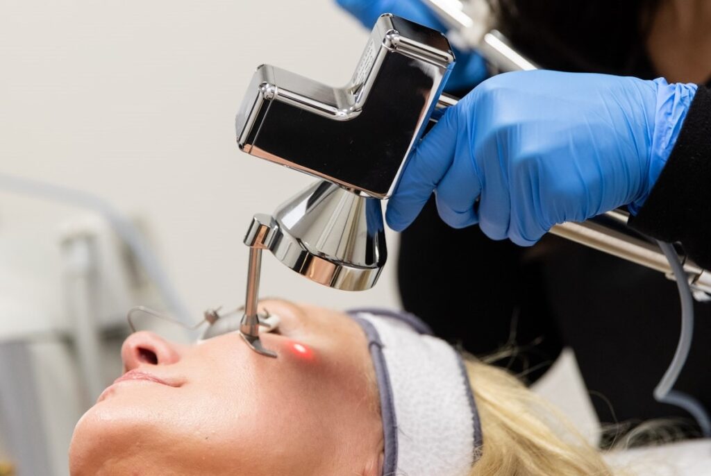 A licensed medical provider uses an ablative CO2 laser near Janesville to refresh and rejuvenate a patient's skin.