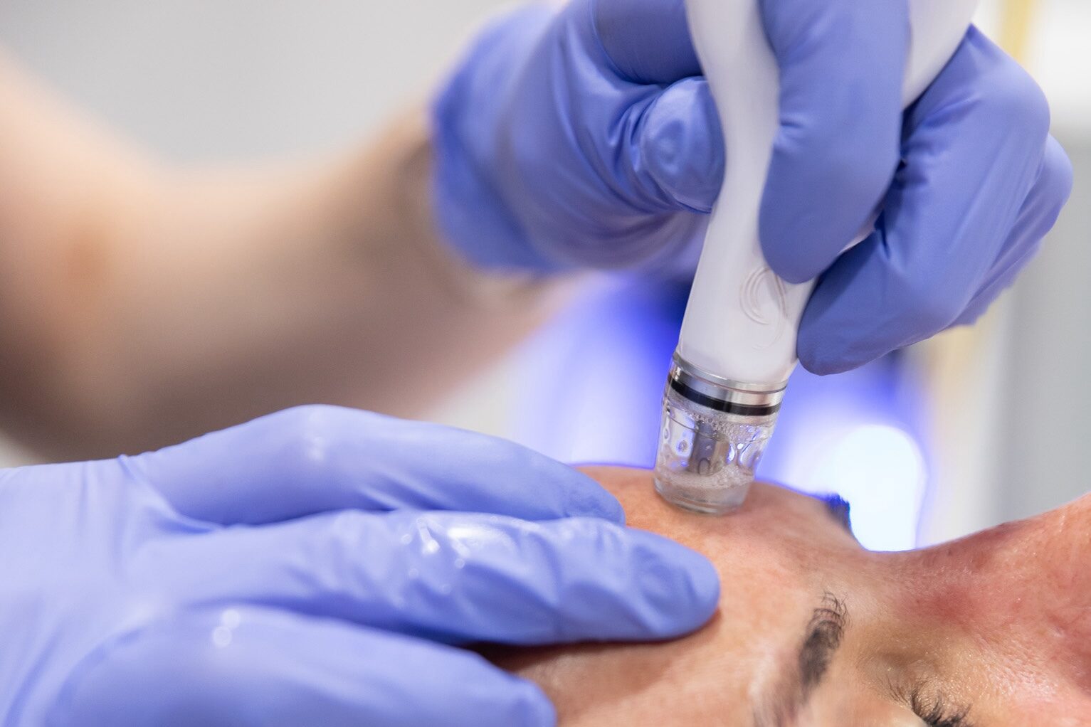 A Medical Grade Aesthetics provider passes the device over a patient's skin during a DiamondGlow facial near Janesville.