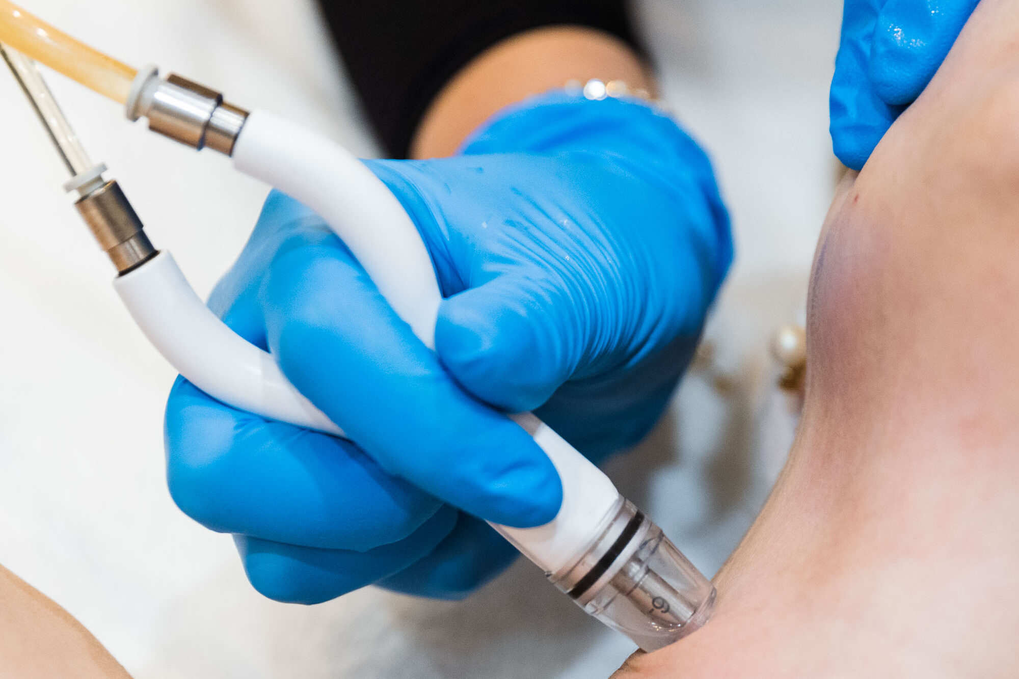 A Medical Grade Aesthetics provider passes the device over a patient's skin during a DiamondGlow facial near Janesville.