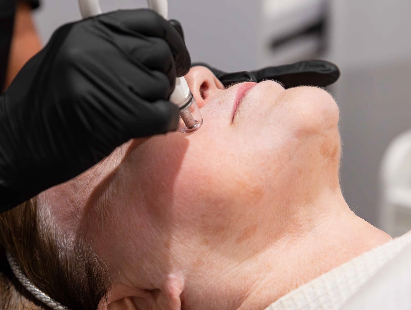 A provider passes the DiamondGlow wand across a patient's skin during her hyperpigmentation treatment near Freeport.