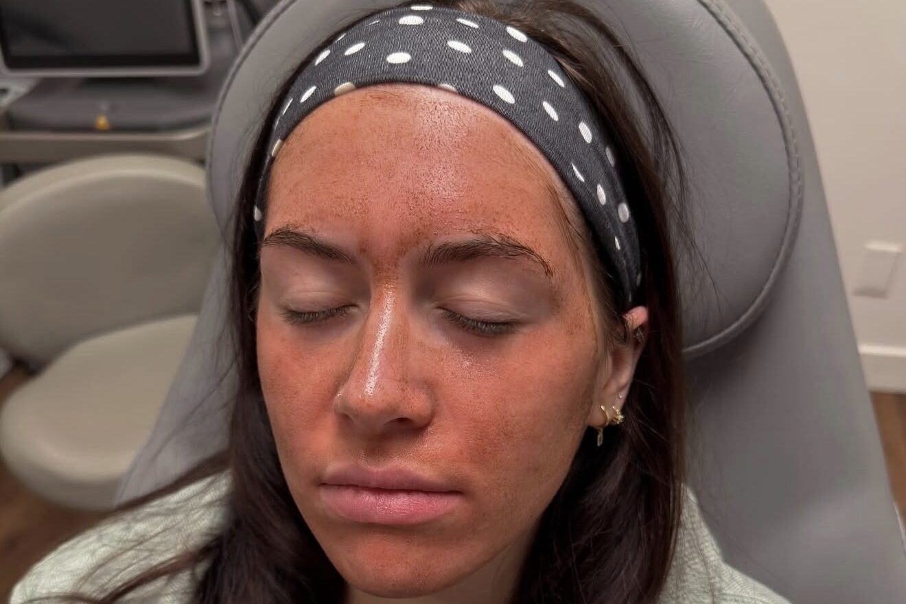 A patient relaxes in the treatment suite as her chemical peel near Janesville takes effect.