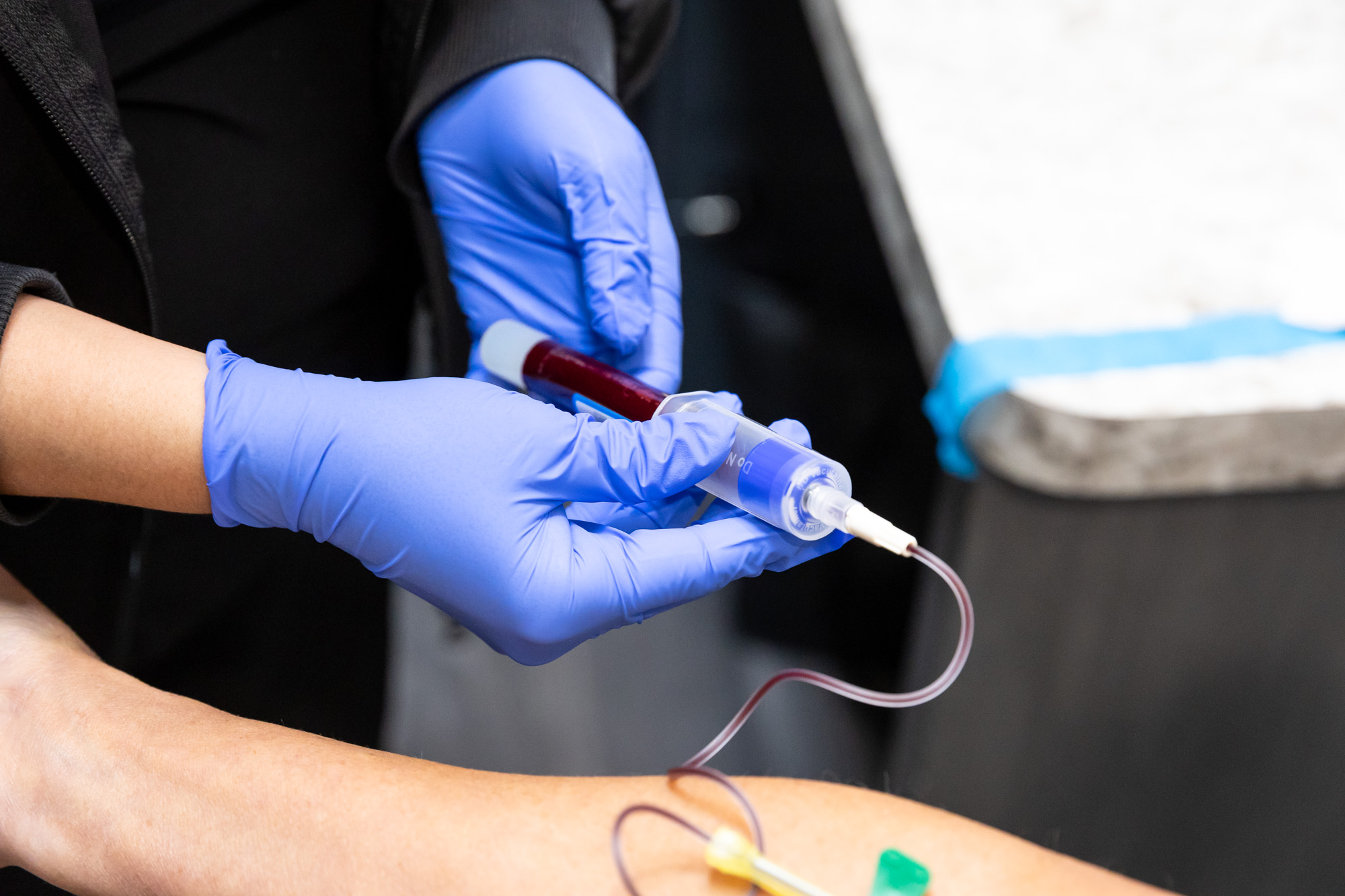 A provider draws a blood sample before performing PRP hair restoration near Janesville.