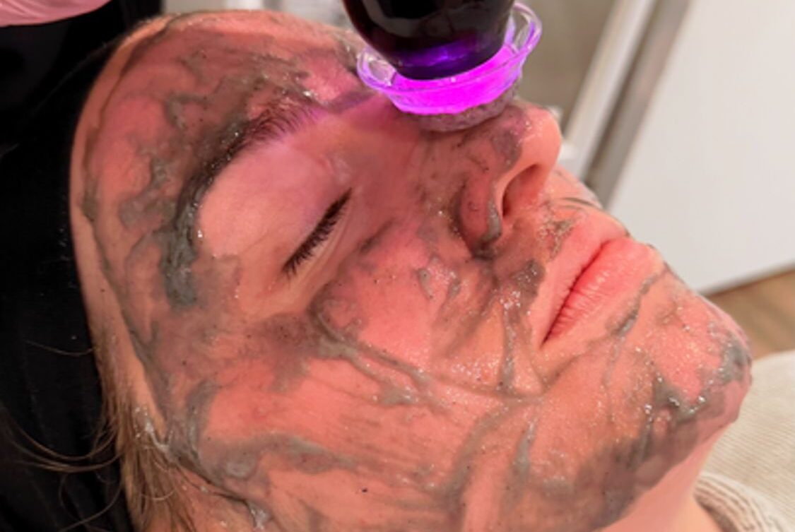 An expert provider uses the Glo2Facial device to administer a patient's deep cleansing facial near Janesville.