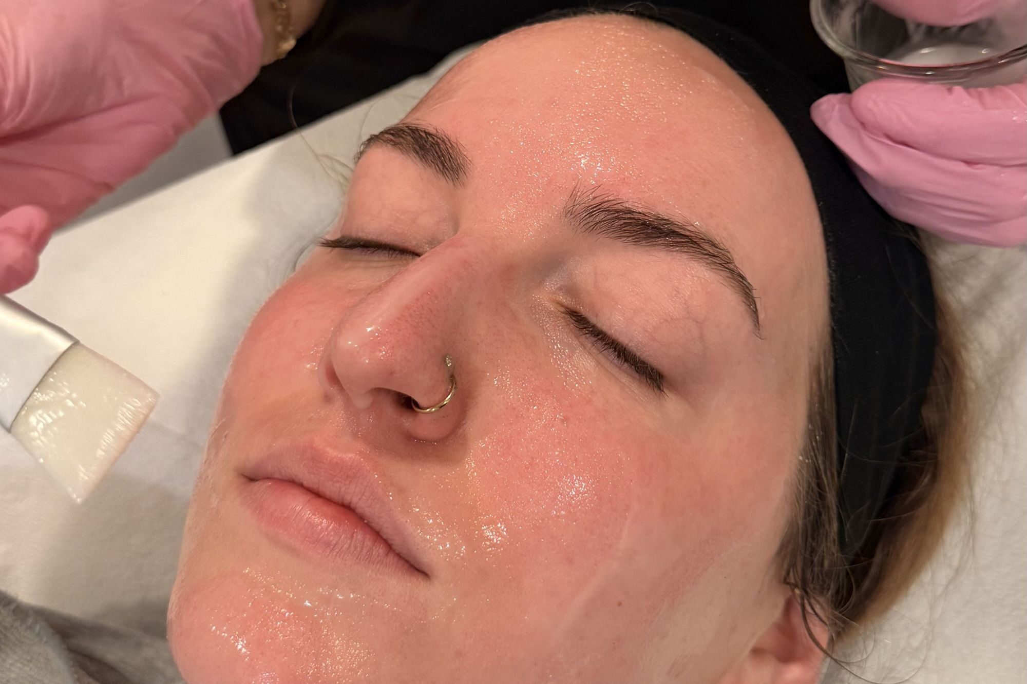 A provider uses optimal techniques and medical-grade products to administer women's and men's facials near Janesville.
